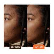 Makari Extreme Argan and Carrot Oil Dark Spot Corrector Serum Targeted Brightening Treatment