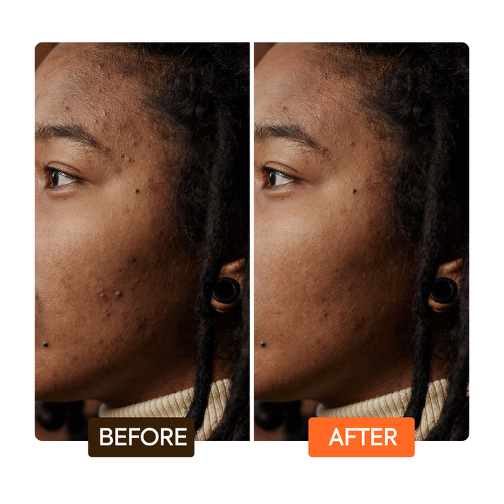 Makari Extreme Argan and Carrot Oil Dark Spot Corrector Serum Targeted Brightening Treatment