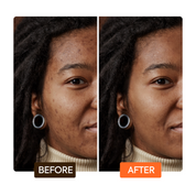 Makari Extreme Argan and Carrot Oil Multi Function Soap Brightening and Exfoliating Bar