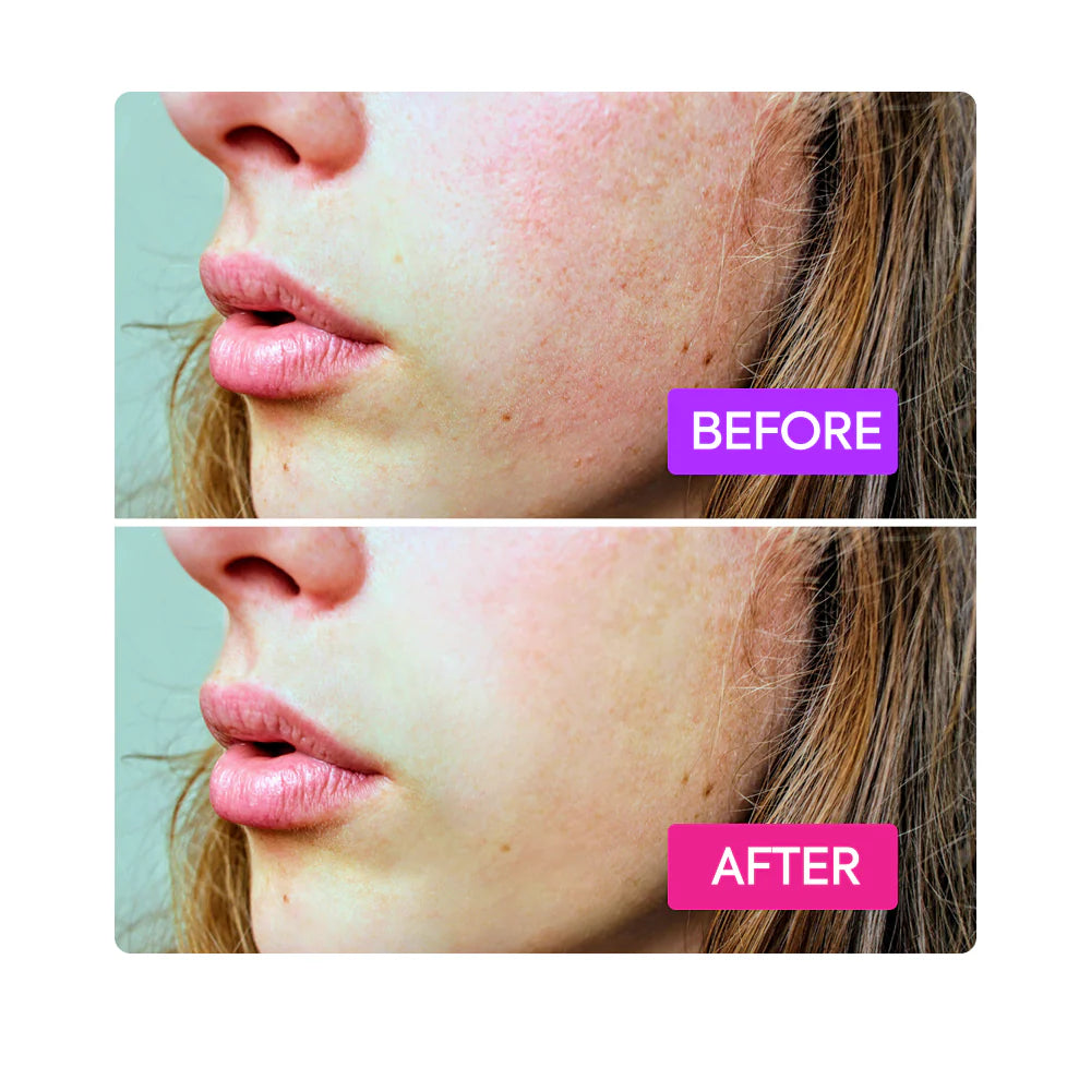 Makari Probiotics Booster 80ml Soothes Protects and Strengthens Skin Barrier IYKYK