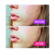 Makari Probiotics Booster 80ml Soothes Protects and Strengthens Skin Barrier IYKYK