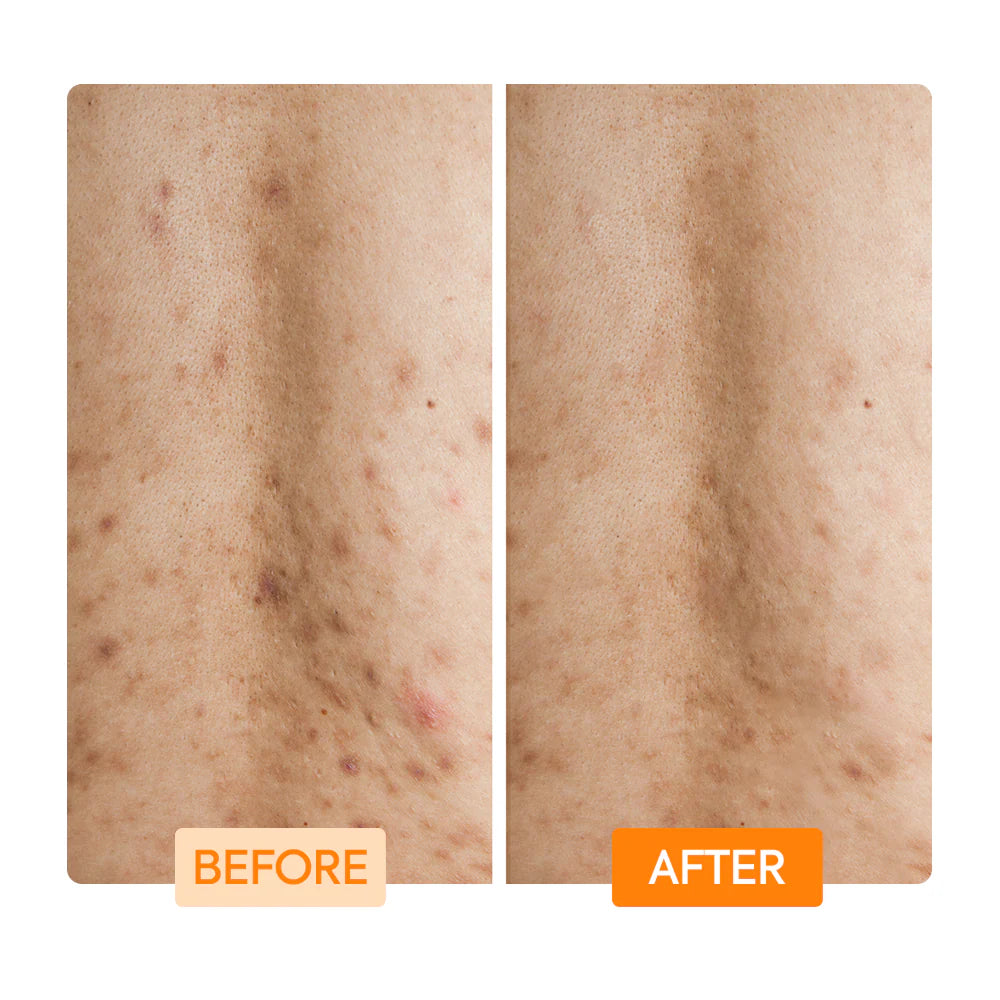 Makari Glycolic Lactic Acid and Niacinamide Body Wash 400ml Smooth Renew IYKYK