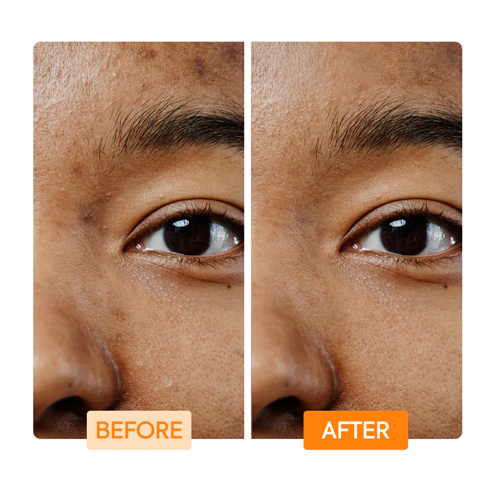 Makari Vitamin C and Turmeric Facial Cleansing Bar 100g Brighten Even Tone IYKYK