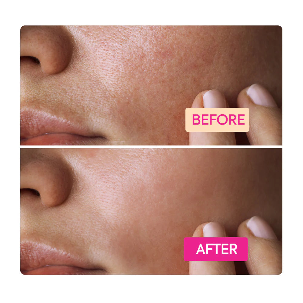 Makari Niacinamide Facial Cleansing Bar 100g Clear Exfoliate and Minimize Pores IYKYK